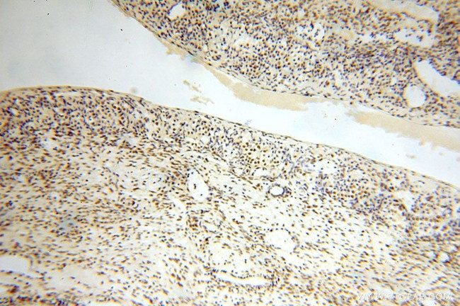 GTF2IRD1 Antibody in Immunohistochemistry (Paraffin) (IHC (P))