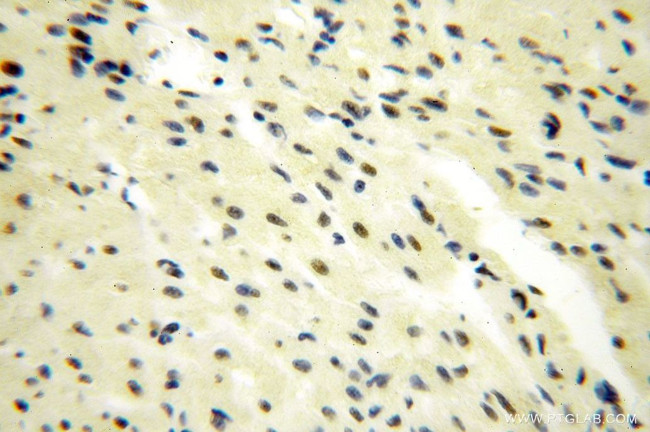 GTF2IRD1 Antibody in Immunohistochemistry (Paraffin) (IHC (P))