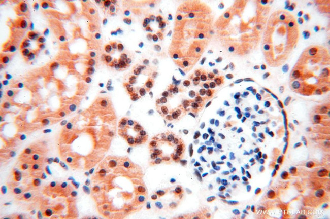 GTF2IRD1 Antibody in Immunohistochemistry (Paraffin) (IHC (P))