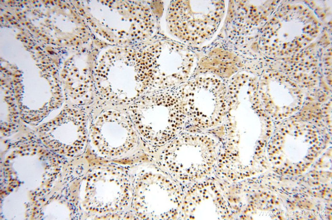 GTF2IRD1 Antibody in Immunohistochemistry (Paraffin) (IHC (P))