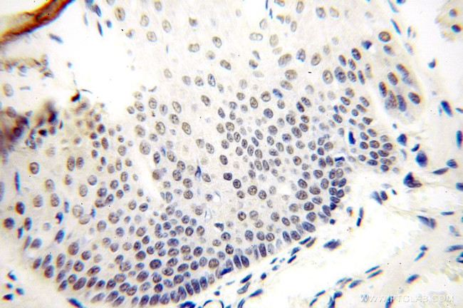 GTF2IRD1 Antibody in Immunohistochemistry (Paraffin) (IHC (P))