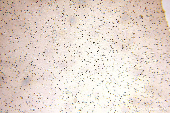 GTF2IRD1 Antibody in Immunohistochemistry (Paraffin) (IHC (P))