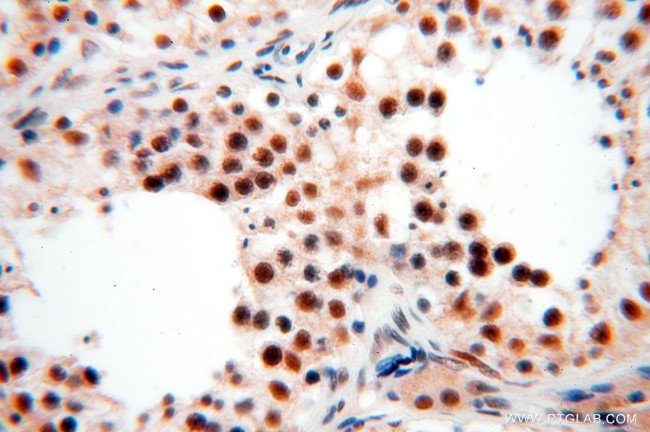 GTF2IRD1 Antibody in Immunohistochemistry (Paraffin) (IHC (P))