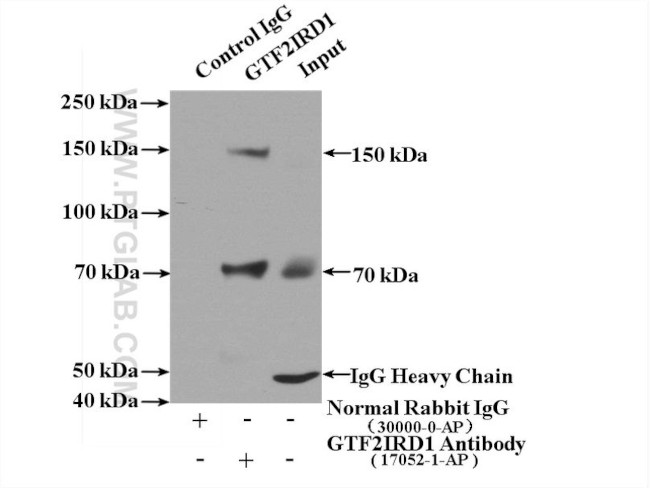 GTF2IRD1 Antibody in Immunoprecipitation (IP)