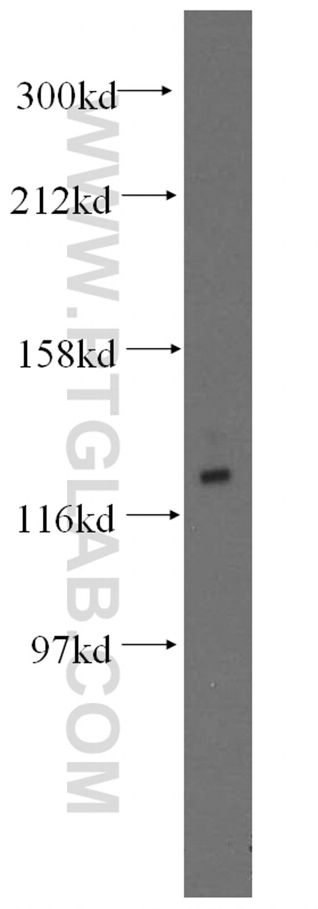 GTF2IRD1 Antibody in Western Blot (WB)