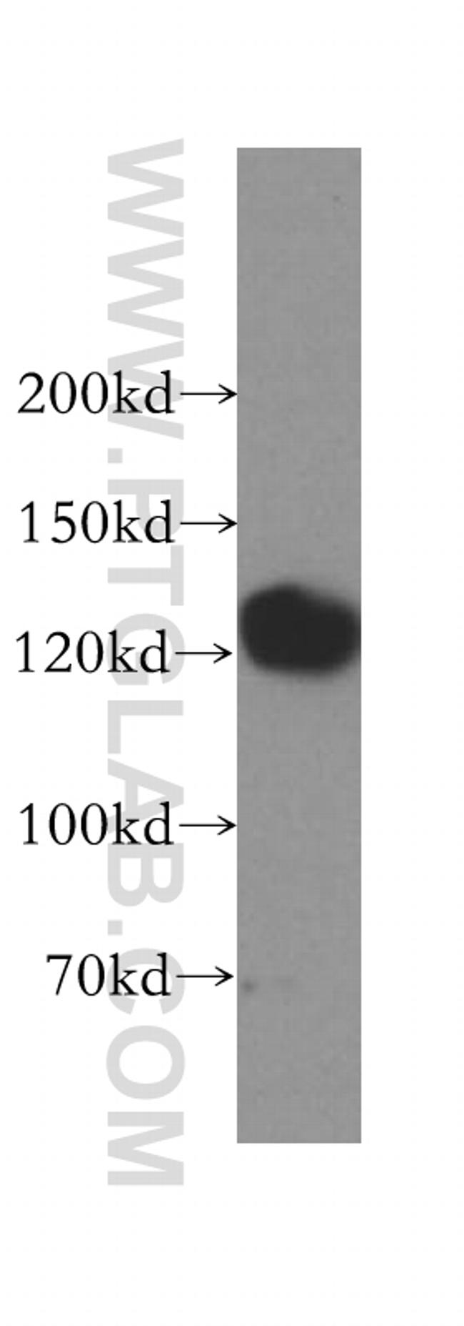 GTF2IRD1 Antibody in Western Blot (WB)