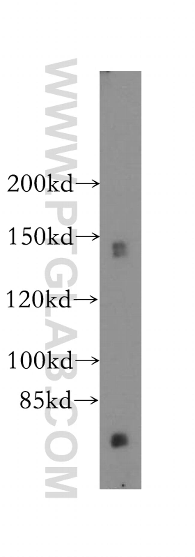 GTF2IRD1 Antibody in Western Blot (WB)