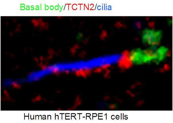 TCTN2 Antibody in Immunocytochemistry (ICC/IF)