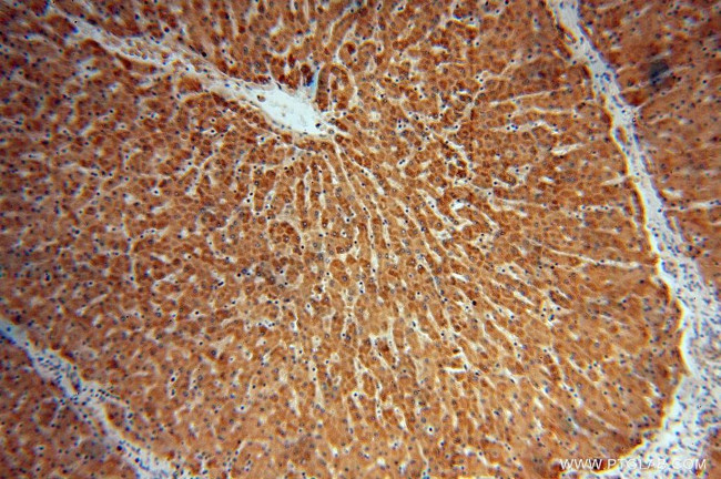 TCTN2 Antibody in Immunohistochemistry (Paraffin) (IHC (P))