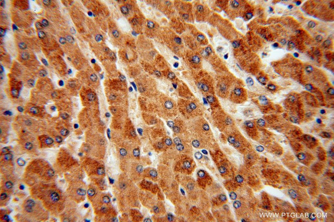 TCTN2 Antibody in Immunohistochemistry (Paraffin) (IHC (P))