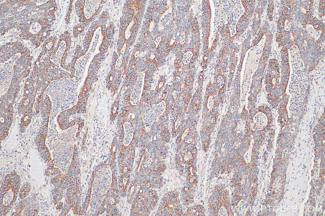 TCTN2 Antibody in Immunohistochemistry (Paraffin) (IHC (P))