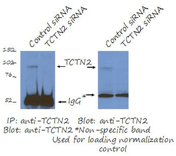 TCTN2 Antibody in Immunoprecipitation (IP)