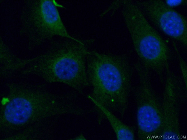 UBE2F Antibody in Immunocytochemistry (ICC/IF)