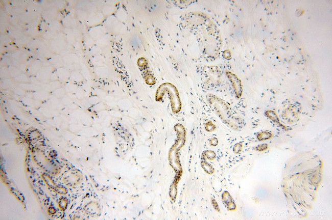 UBE2F Antibody in Immunohistochemistry (Paraffin) (IHC (P))