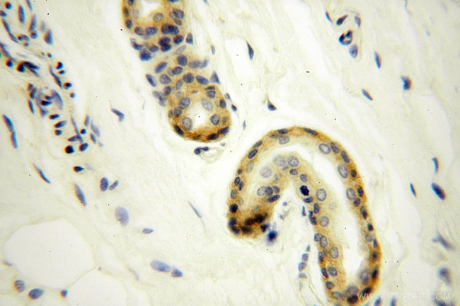 UBE2F Antibody in Immunohistochemistry (Paraffin) (IHC (P))