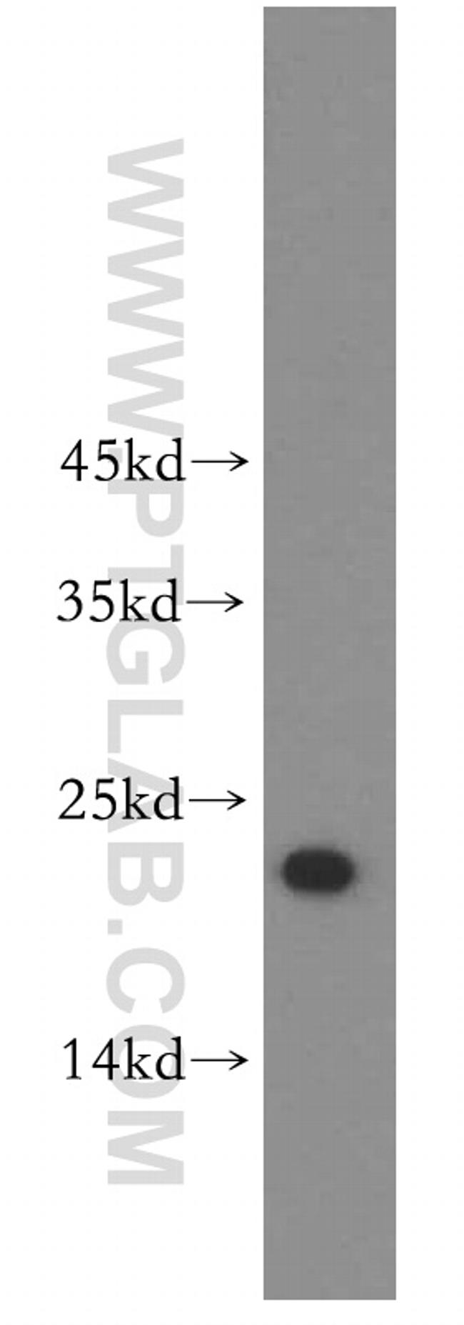 UBE2F Antibody in Western Blot (WB)