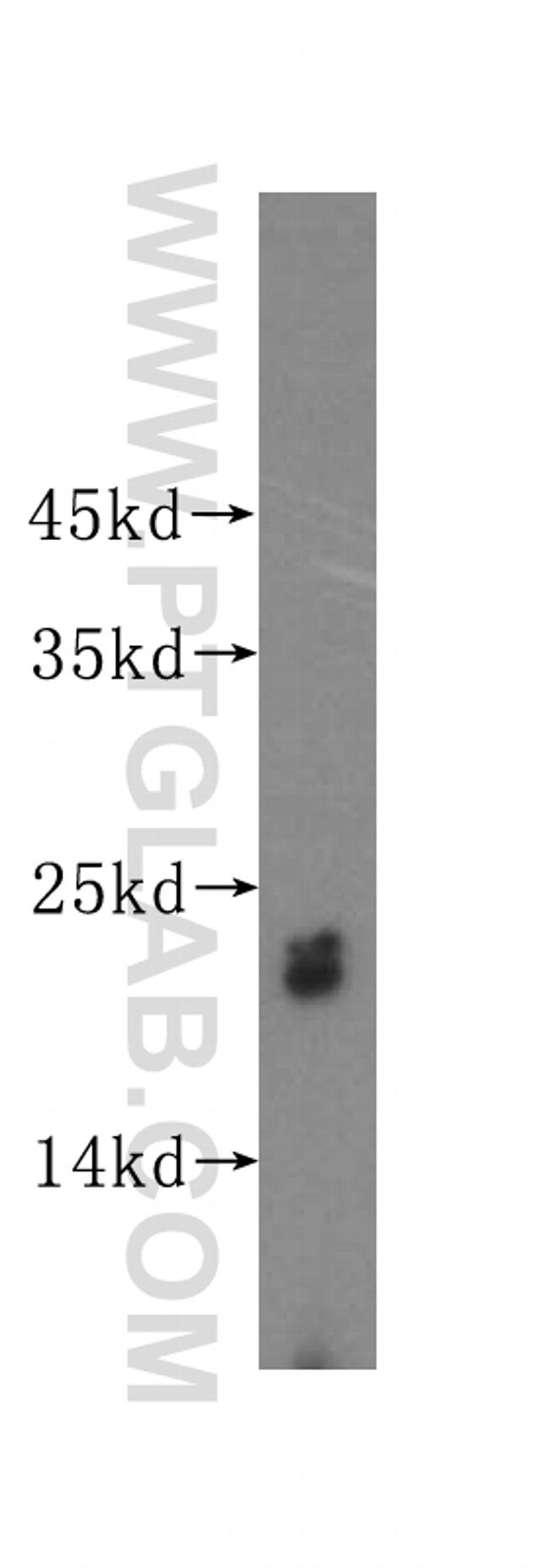 UBE2F Antibody in Western Blot (WB)