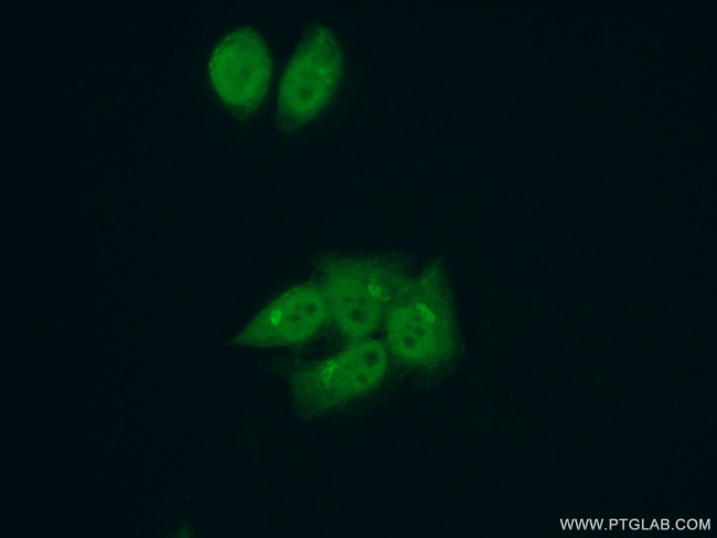 LARP7 Antibody in Immunocytochemistry (ICC/IF)