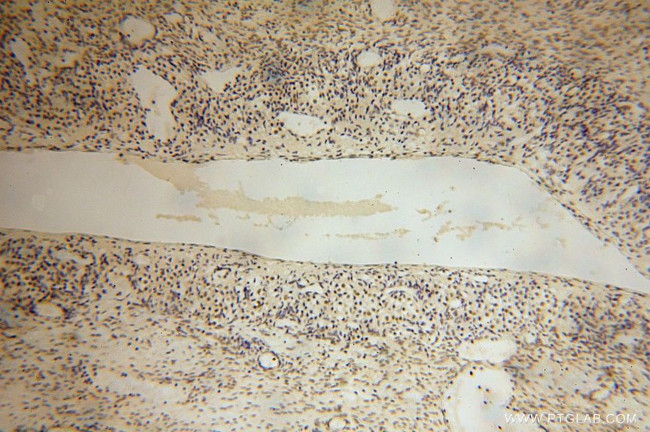 LARP7 Antibody in Immunohistochemistry (Paraffin) (IHC (P))