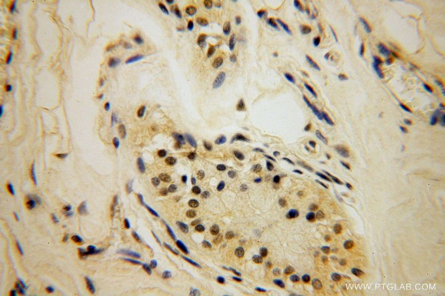 LARP7 Antibody in Immunohistochemistry (Paraffin) (IHC (P))