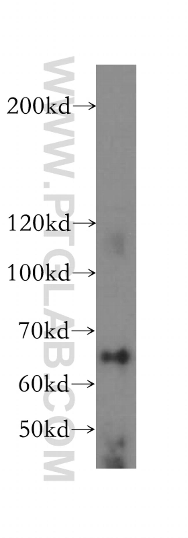 LARP7 Antibody in Western Blot (WB)