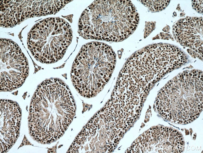 TEX12 Antibody in Immunohistochemistry (Paraffin) (IHC (P))