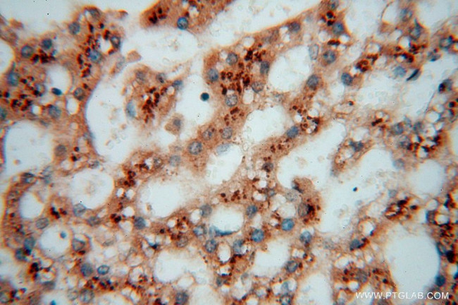 TEX12 Antibody in Immunohistochemistry (Paraffin) (IHC (P))