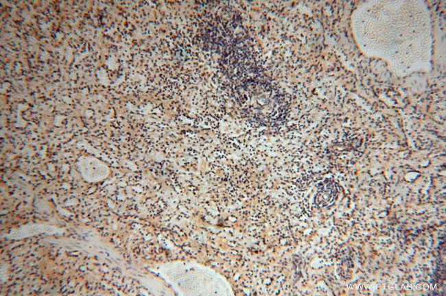 TEX12 Antibody in Immunohistochemistry (Paraffin) (IHC (P))