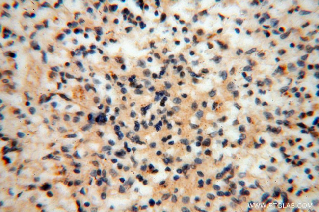 TEX12 Antibody in Immunohistochemistry (Paraffin) (IHC (P))