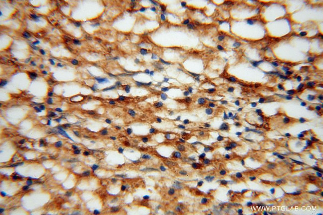 TEX12 Antibody in Immunohistochemistry (Paraffin) (IHC (P))