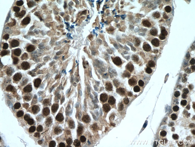 TEX12 Antibody in Immunohistochemistry (Paraffin) (IHC (P))