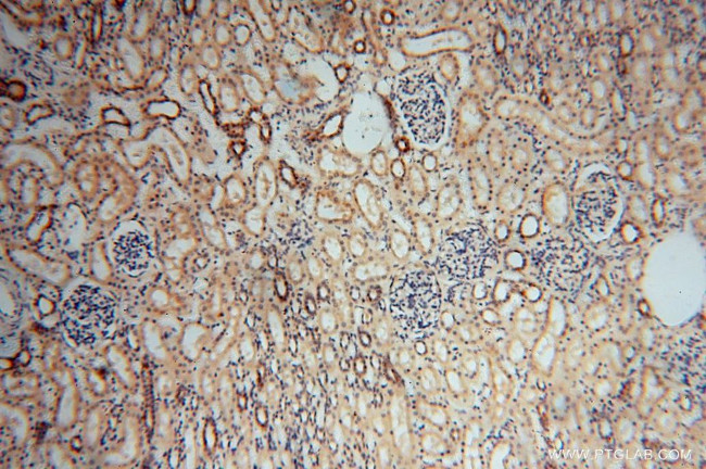 TEX12 Antibody in Immunohistochemistry (Paraffin) (IHC (P))