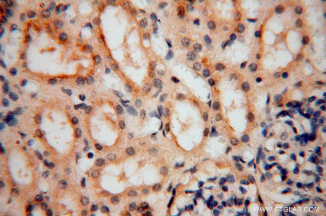 TEX12 Antibody in Immunohistochemistry (Paraffin) (IHC (P))