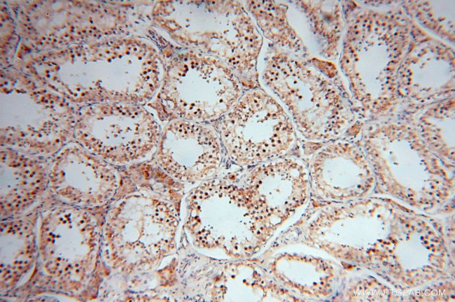 TEX12 Antibody in Immunohistochemistry (Paraffin) (IHC (P))