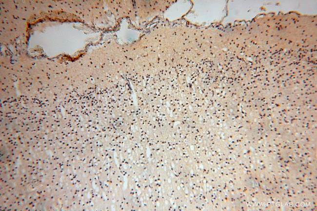 TEX12 Antibody in Immunohistochemistry (Paraffin) (IHC (P))