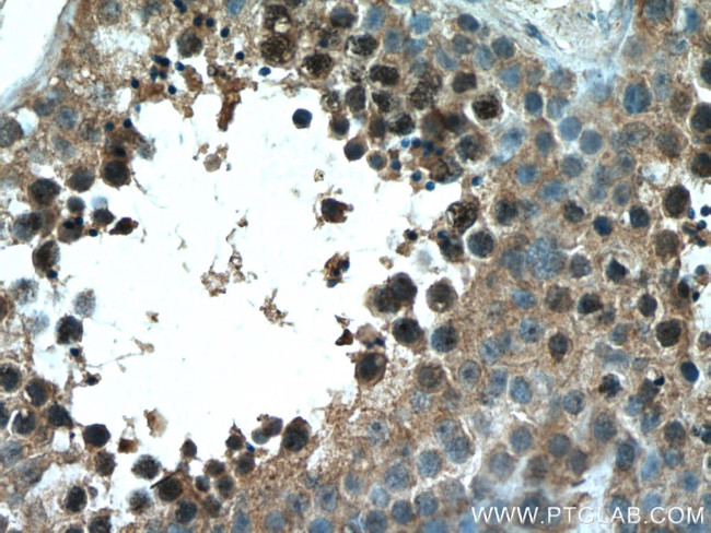 TEX12 Antibody in Immunohistochemistry (Paraffin) (IHC (P))