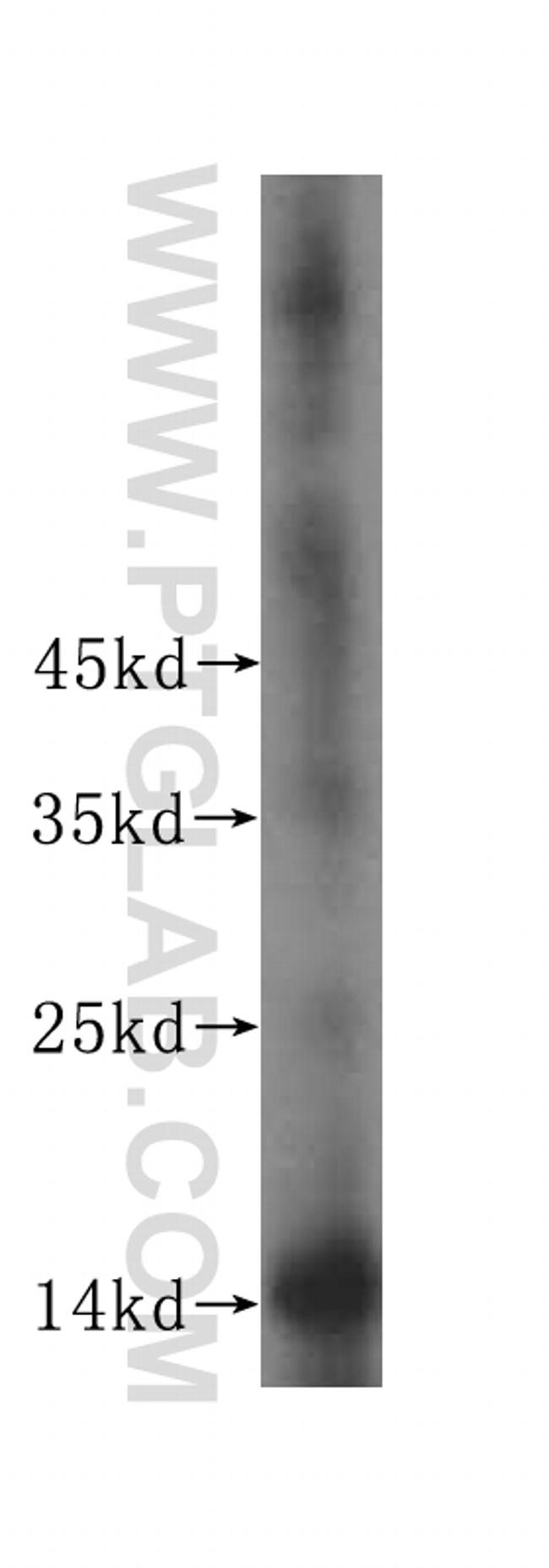 TEX12 Antibody in Western Blot (WB)