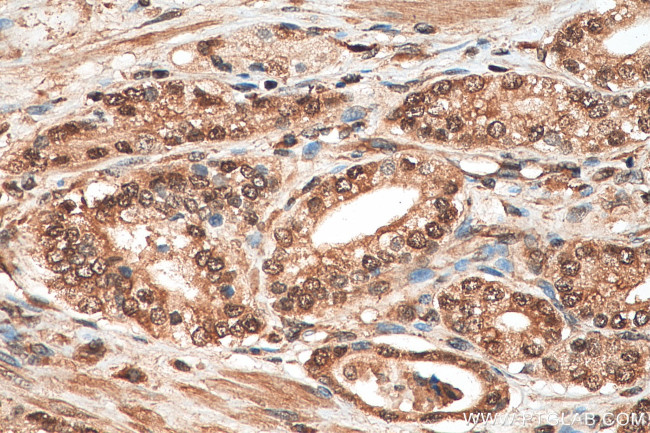 EIF5A2 Antibody in Immunohistochemistry (Paraffin) (IHC (P))