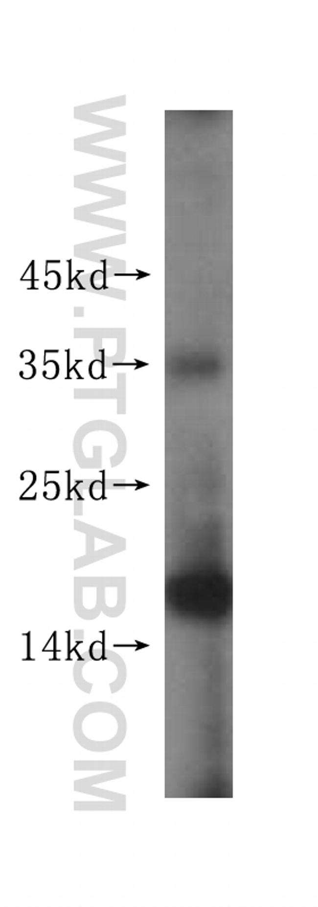 EIF5A2 Antibody in Western Blot (WB)