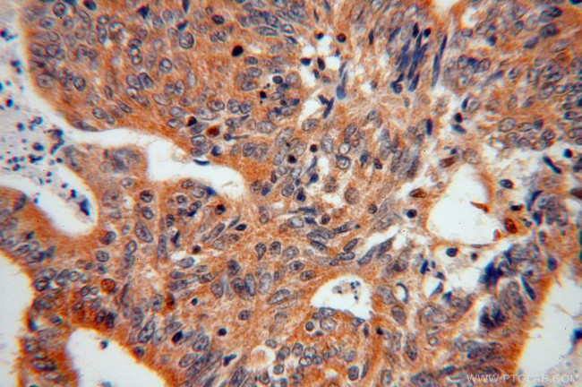 EIF5A2 Antibody in Immunohistochemistry (Paraffin) (IHC (P))