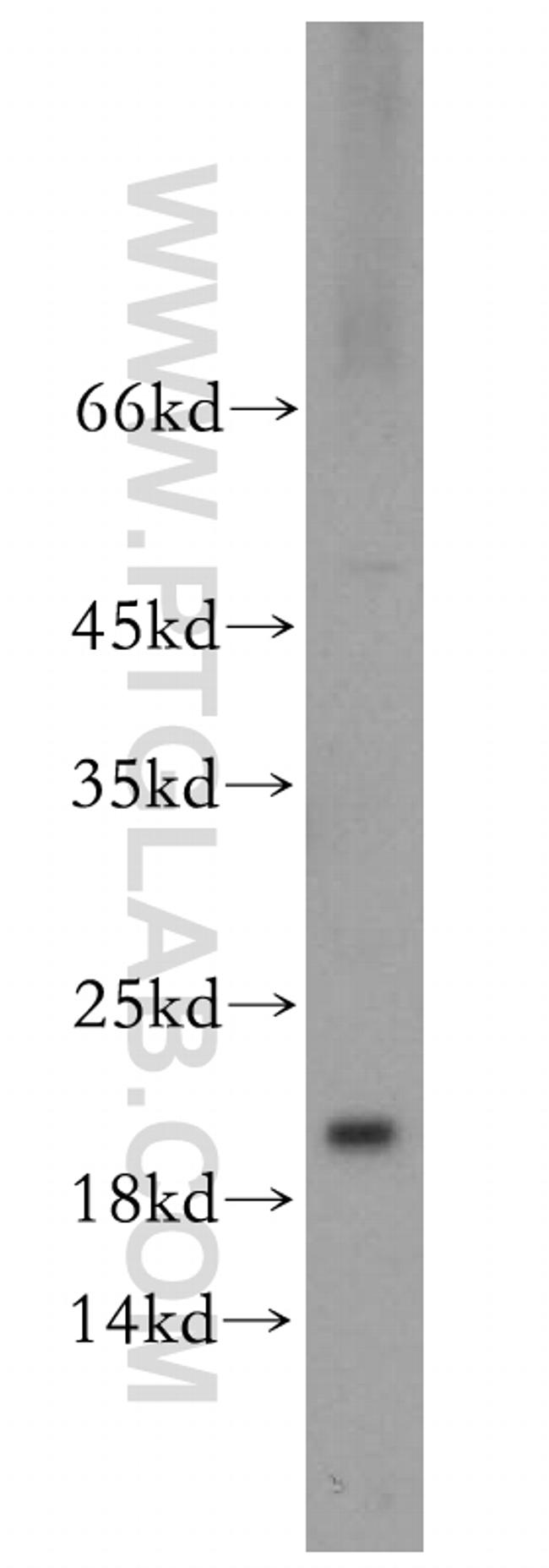 EIF5A2 Antibody in Western Blot (WB)