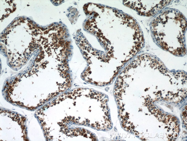 LZTFL1 Antibody in Immunohistochemistry (Paraffin) (IHC (P))