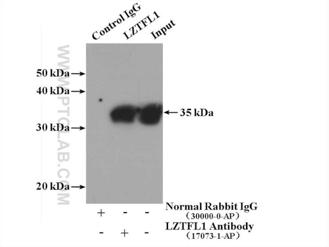 LZTFL1 Antibody in Immunoprecipitation (IP)