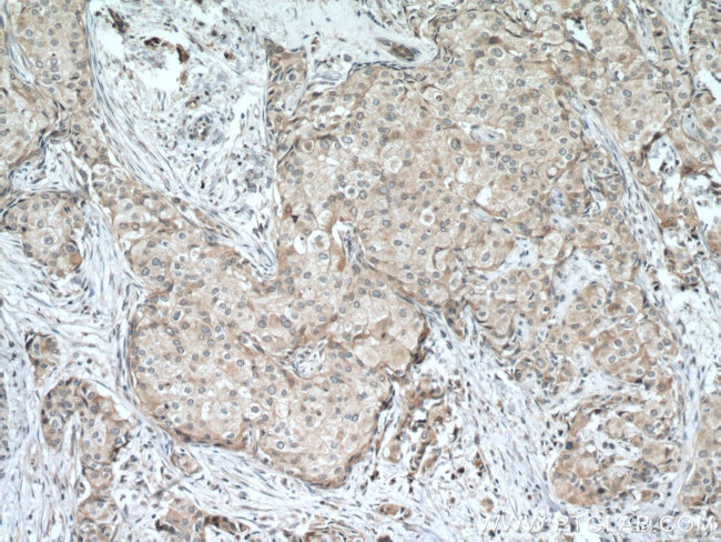 CST6 Antibody in Immunohistochemistry (Paraffin) (IHC (P))