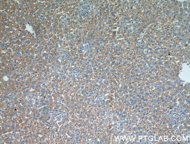 CST6 Antibody in Immunohistochemistry (Paraffin) (IHC (P))