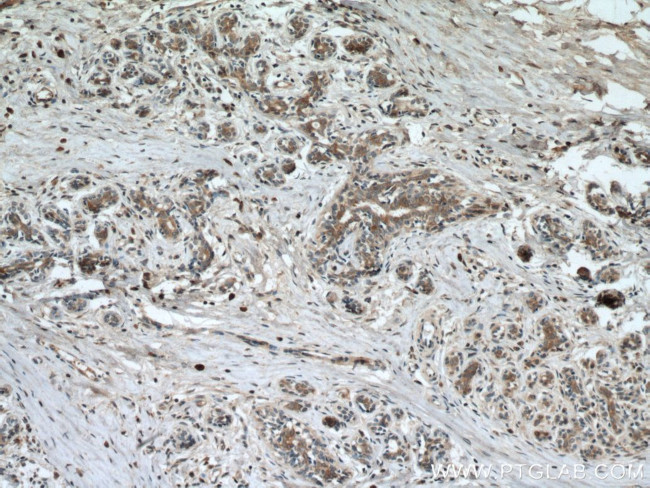 CST6 Antibody in Immunohistochemistry (Paraffin) (IHC (P))