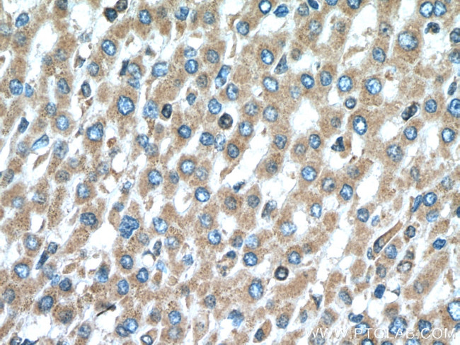 PIP4K2C Antibody in Immunohistochemistry (Paraffin) (IHC (P))