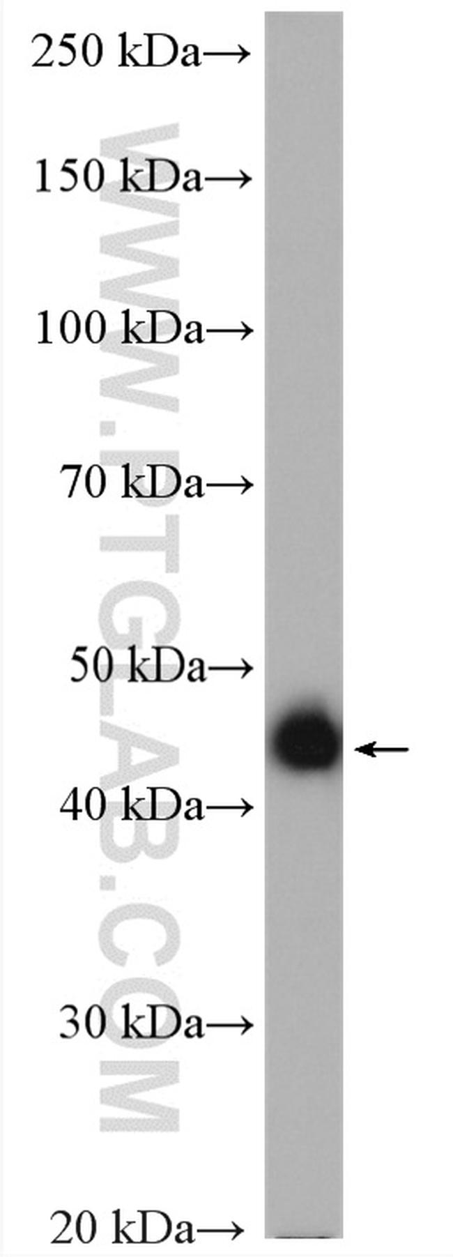 PIP4K2C Antibody in Western Blot (WB)