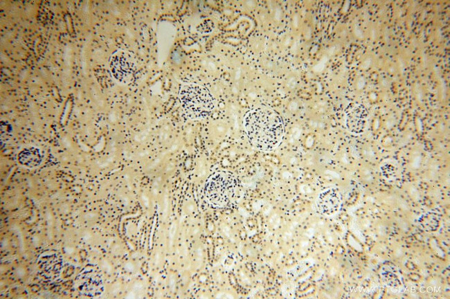 TBC1D5 Antibody in Immunohistochemistry (Paraffin) (IHC (P))