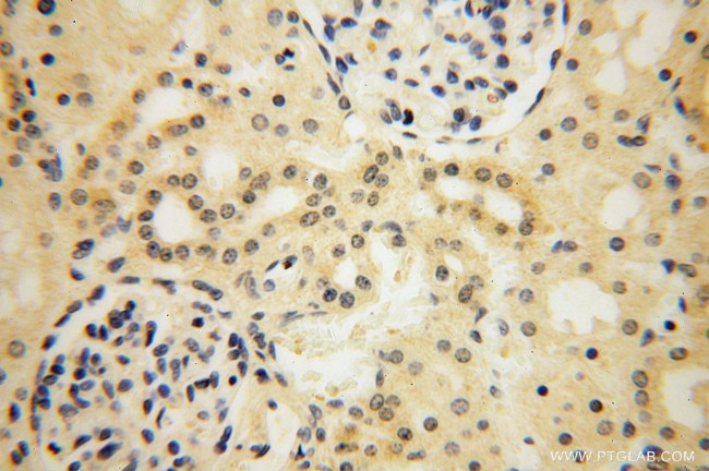 TBC1D5 Antibody in Immunohistochemistry (Paraffin) (IHC (P))